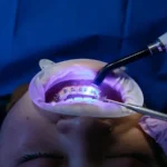 pediatric dentist in Moreno Valley