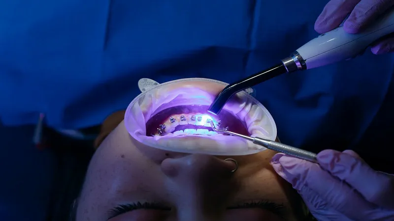 pediatric dentist in Moreno Valley